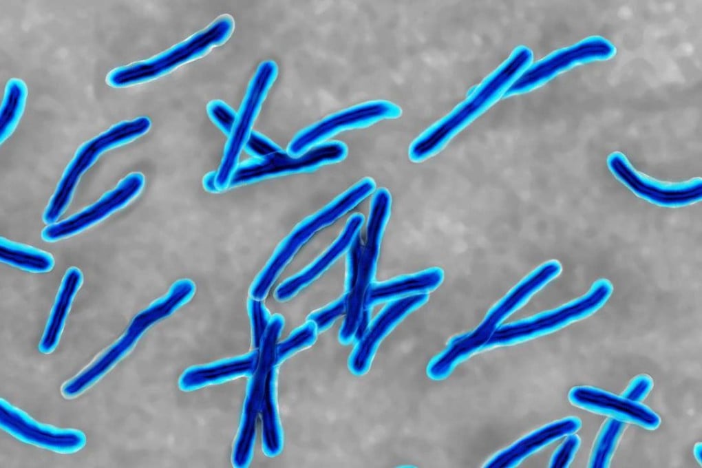 Mycobacterium tuberculosis under a microscope.