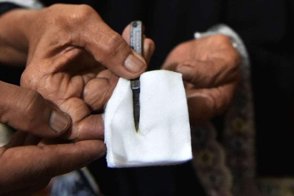 A traditional healer shows cutting tools used to circumcise women in Gorontalo. Photo: AFP