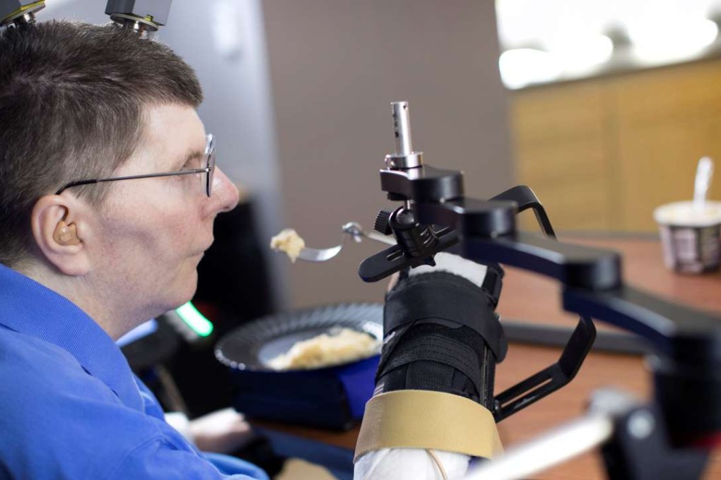 Bill Kochevar, 56, is using computer-brain interface technology and an electrical stimulation system to move his own arm after eight years of paralysis. Photo: Reuters