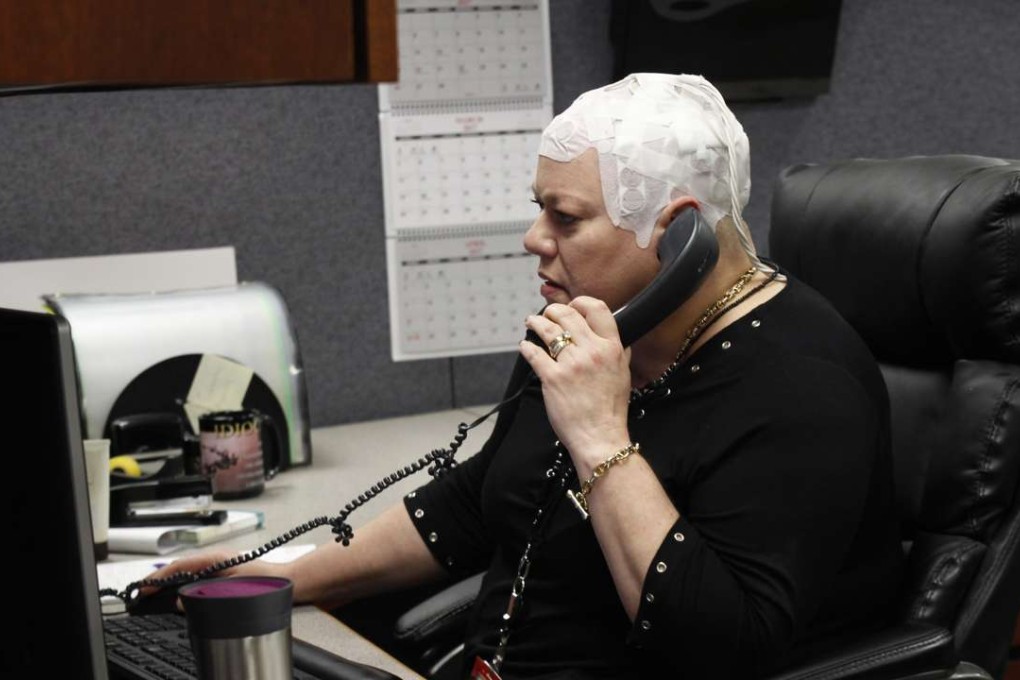 In this March 29, 2017 photo, Joyce Endresen wears an Optune therapy device for brain cancer, as she speaks on a phone at work in Aurora, Illinois. She was diagnosed in December 2014 with Glioblastoma. She had two surgeries to remove the tumour as well as radiation and chemotherapy, but is now trying the new Optune therapy that requires her to wear the electrodes on her head as much as possible. Photo: AP