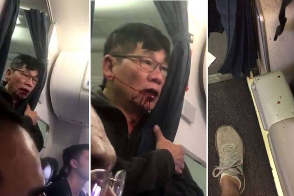 Images of David Dao, the passenger who was violently ejected from the United Airlines flight in Chicago. Photo: Handout