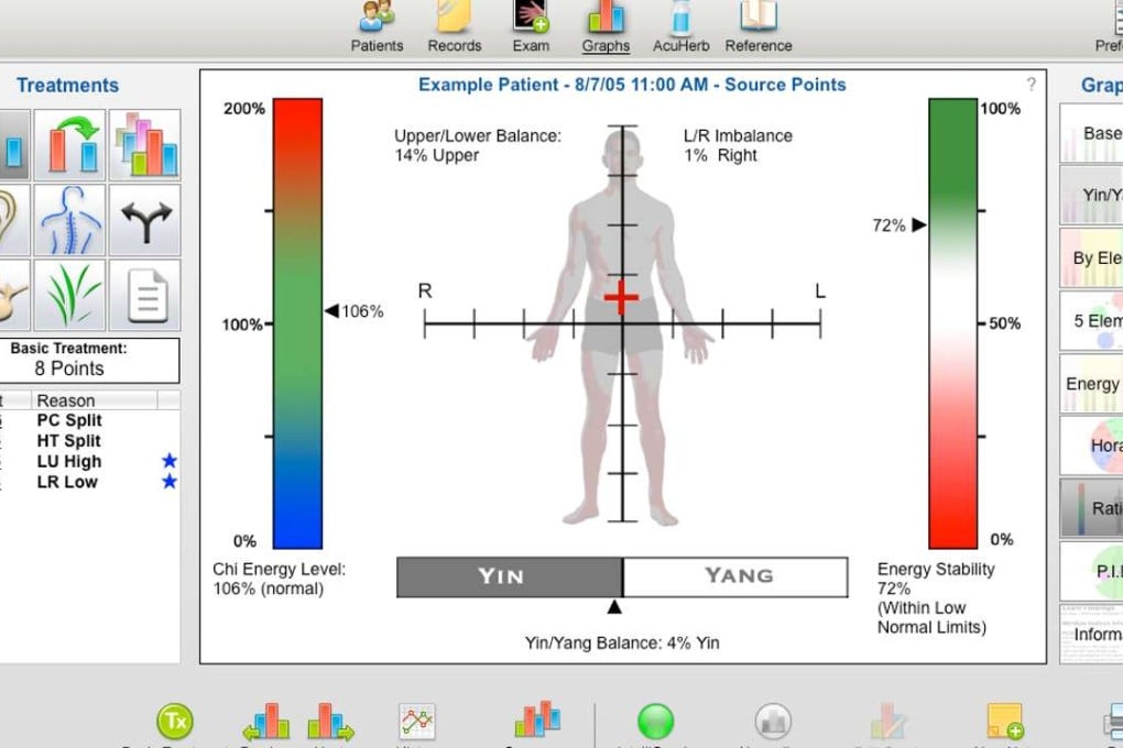 The Acugraph Meridien Test is a 20-minute exam that claims to show any imbalances and the correlation to physical problems and imbalances. Photo: Dr Susan Jamieson Integrative Medical Practice