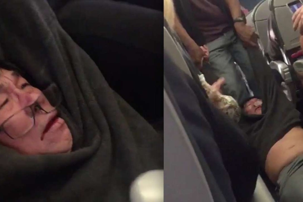 There is zero evidence United used ethnicity to select David Dao as one of four passengers it bumped, even his own lawyer, said so. Photo: Facebook