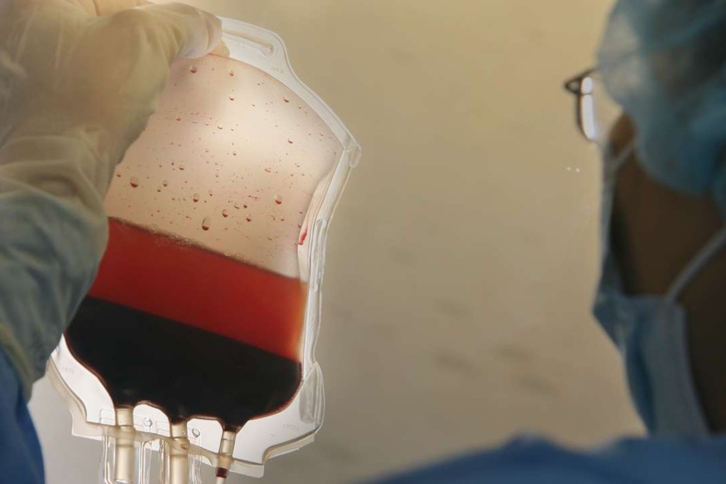 A protein in human umbilical cord blood injected into ageing mice improved their cognitive ability. Photo: K.Y. Cheng