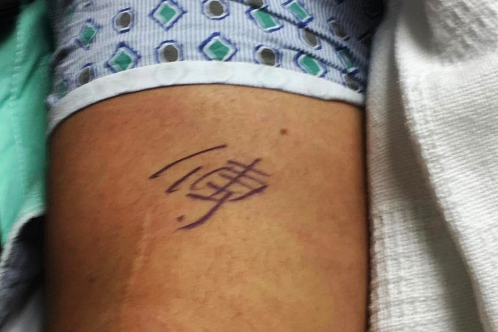 The Chinese character for 'Fu' above the operation scar on Zlatan's knee. Photo: Zlatan Ibrahimovic/Instagram