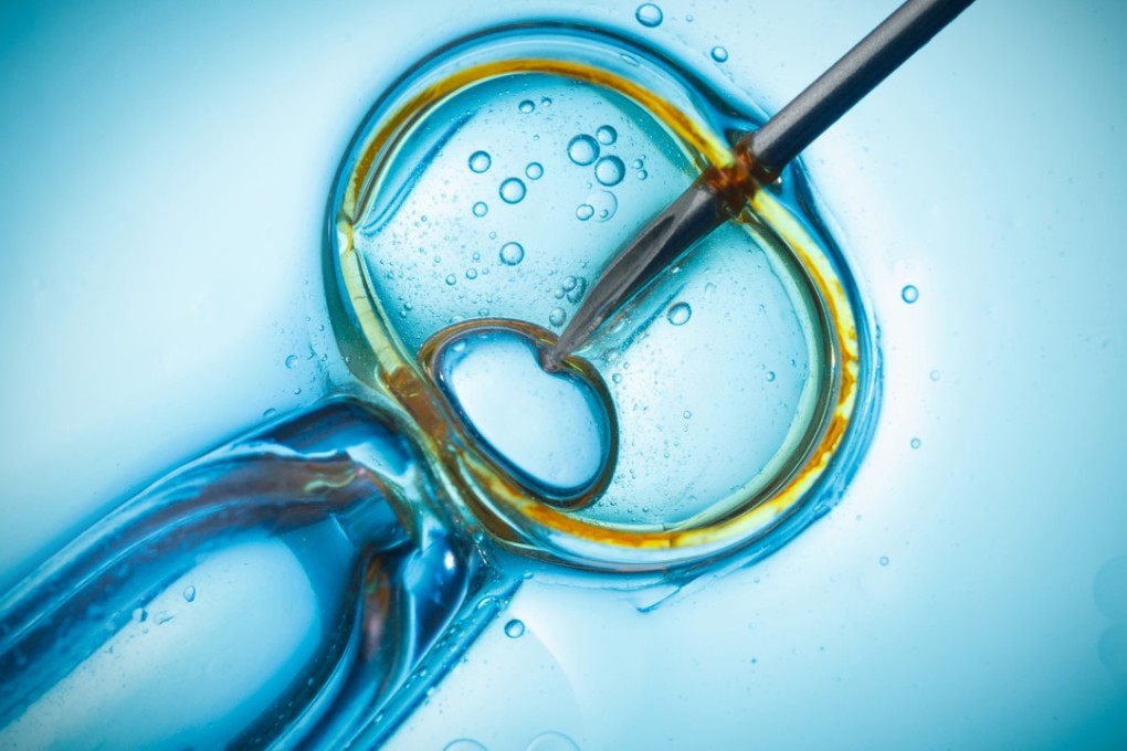 Hong Kong women aged 21-25 and 31-35 were the most likely to get pregnant after IVF treatment, according to a recent study. Photo: ShutterstockIVF by intracytoplasmic sperm injection
