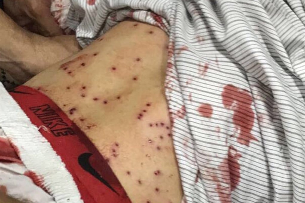 People treat a man who was injured by birdshot in the Bahrain raid. Photo: AP