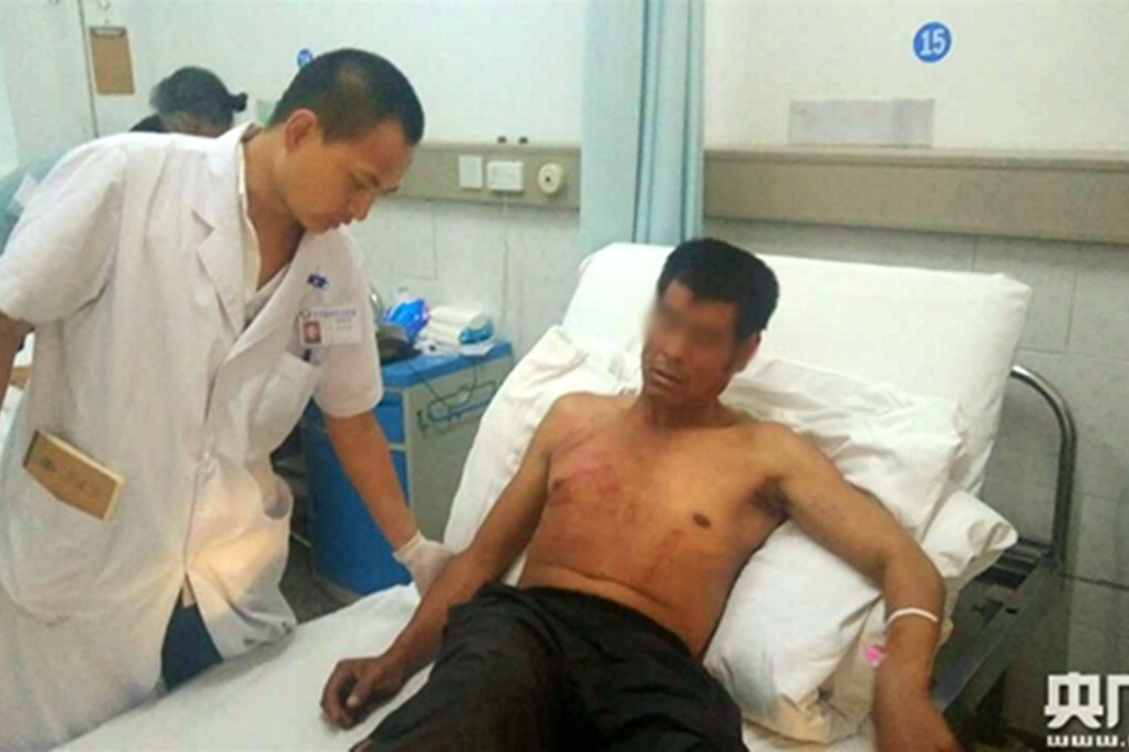 The injured man in hospital. Photo: Cnr.cn