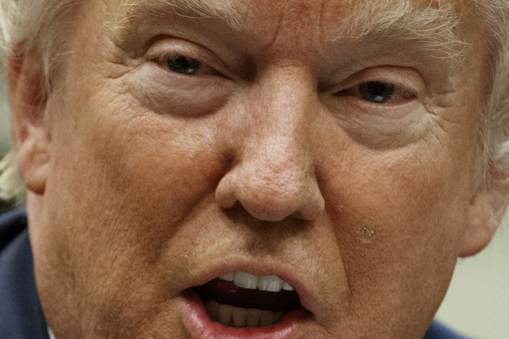 Donald Trump is a late sleeper. Photo: AFP