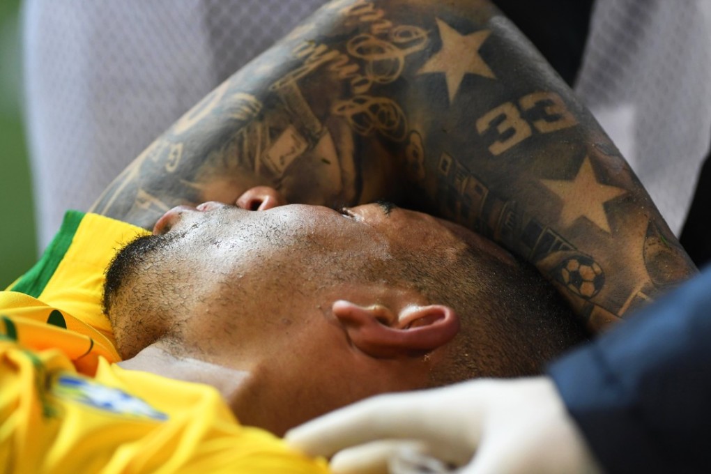 Gabriel Jesus is stretchered off the pitch after suffering a broken eye socket against Argentina in Melbourne. Photo: EPA