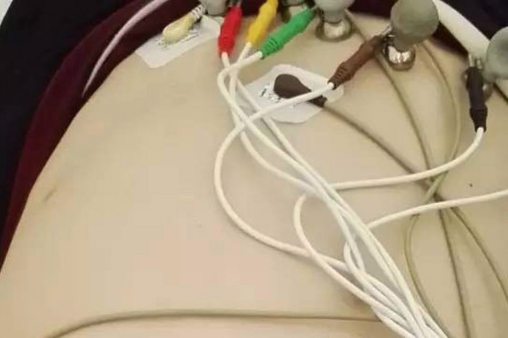 The man’s stomach was severely distended when he sought medical help. Photo: Handout