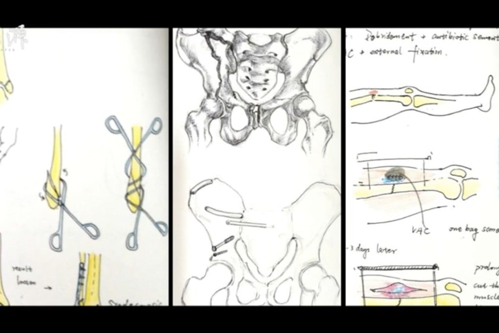 Some of the doctor’s drawings explaining surgical procedures. Photo: Handout