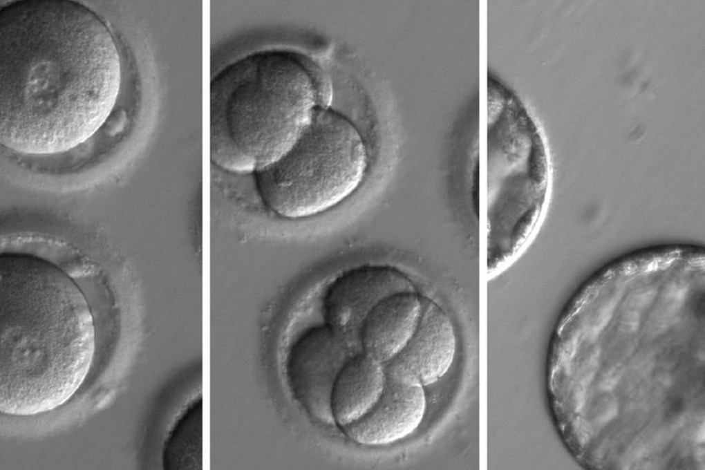 An undated composite handout photo made available by the Oregon Health and Science University shows a sequence of the development of embryos after co-injection of a gene-correcting enzyme and sperm from a donor with a genetic mutation known to cause hypertrophic cardiomyopathy. Photo: EPA
