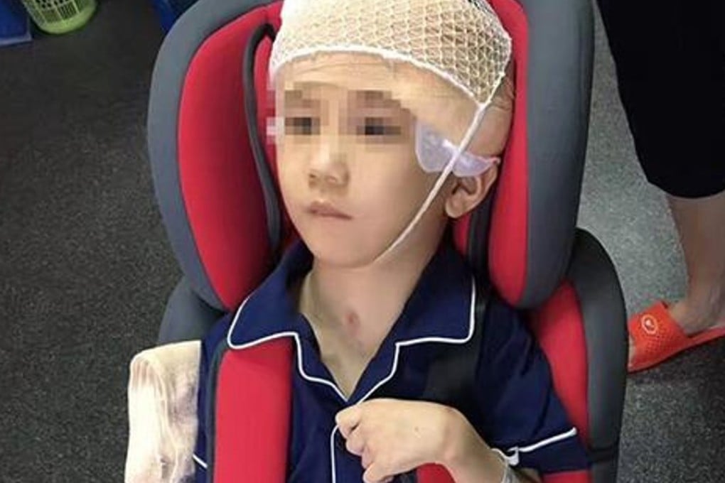 Six-year-old Pengpeng has undergone surgery to ease the pressure on his skull from a build-up of blood. Photo: Handout