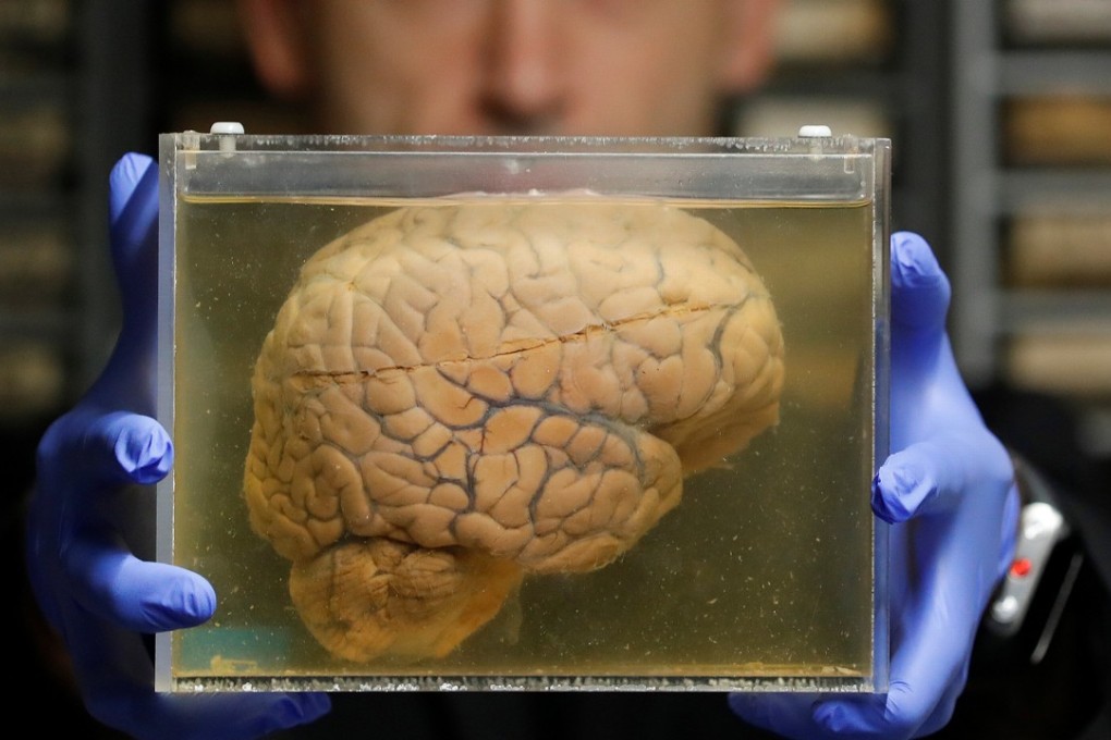 Belgian researcher Manuel Morrens holds a container with a human brain, part of a collection of more than 3,000 brains at the psychiatric hospital in Duffel, Belgium. Photo: Reuters