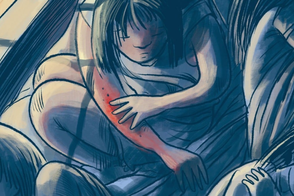 The opening story in Sour Heart, by Jenny Zhang, is about Christina, who lives with her parents in Brooklyn and whose skin constantly itches from the bedbugs, “like there were little tiny ants carrying sticks of fire and doing somersaults and cartwheels all over my body”. Illustration: Adolfo Arranz