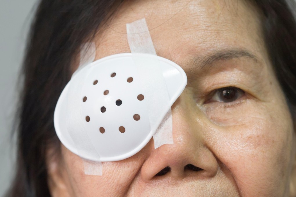 A total of 280 patients are waiting for eye transplants. Photo: Alamy