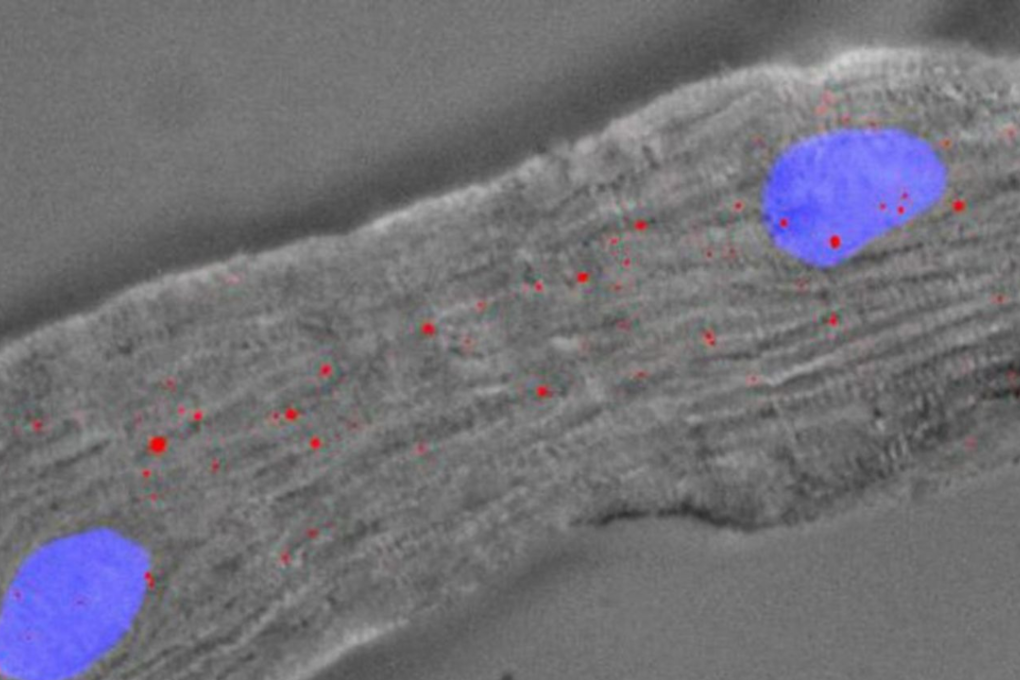 A mouse heart cell with 2 nuclei (blue) and Singheart RNA labelled by red fluorescent dyes. Photo: A*STAR’s Genome Institute of Singapore