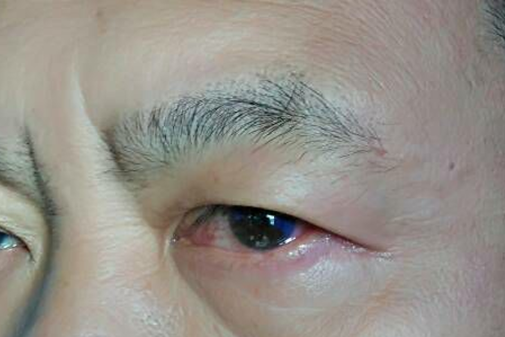 Photo: Thomas Fann/Facebook