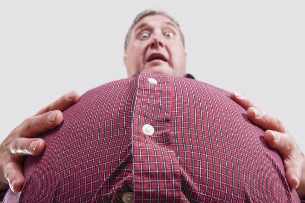 To lose weight, an expert says, patients need to look at changing their lifestyle not just their diet.