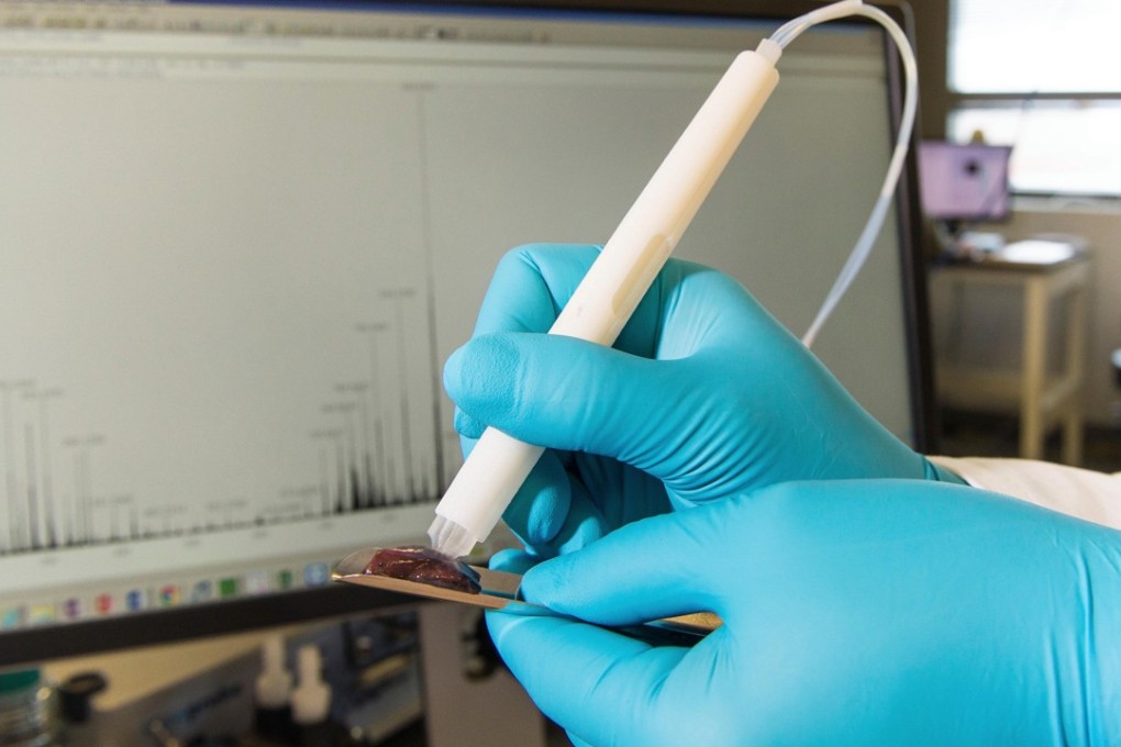 Pencil-sized tool spots cancer cells in seconds, offering safer, more ...