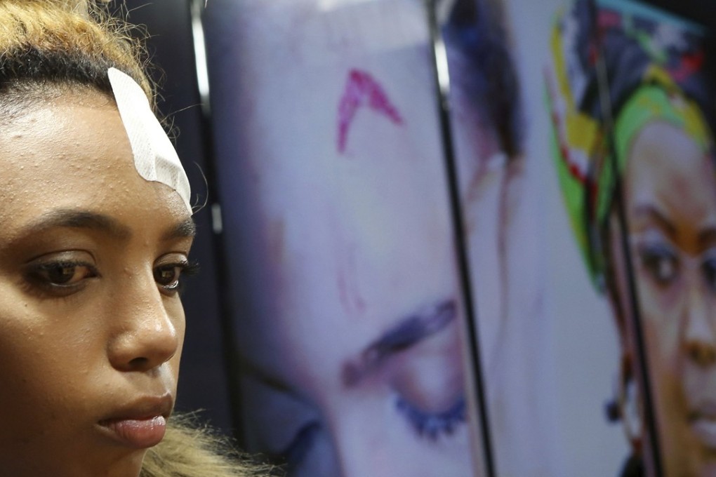 South African model Gabriella Engels, who was allegedly assaulted by Zimbabwe first lady Grace Mugabe. Photo: AFP