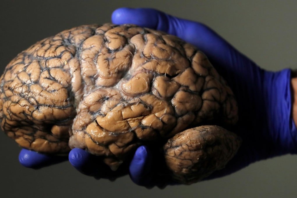 Belgian researcher Jeroen Schuermans holds a human brain at the psychiatric hospital in Duffel, Belgium. Doctors say stimulation of the brain’s vagus nerve holds promise for treating patients in vegetative states. Photo: Reuters