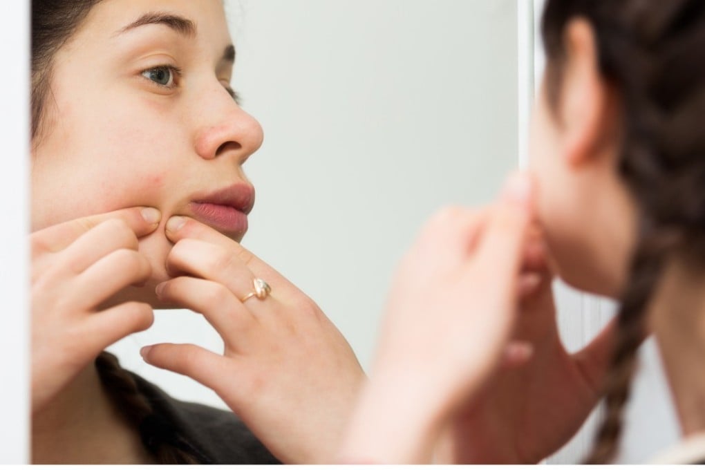 Teenagers’ bodies undergo a lot of changes. Their minds don’t catch up until they are in their mid-20s.