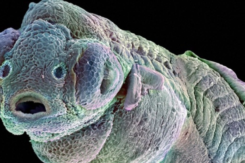 Chinese scientists have captured a visual representation of a larval zebrafish thinking about its dinner in a rare glimpse inside the brain of a free moving animal. Photo: Wellcome Images