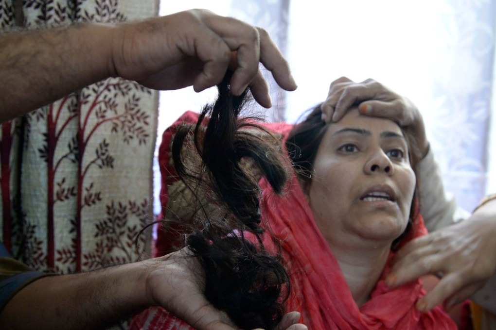 Kashmiri resident Tasleema: ‘Just as I turned after opening the door someone tried to strangle me from behind. I saw his face covered by a black mask, I saw his eyes. Then I don’t know what happened’. Photo: AFP