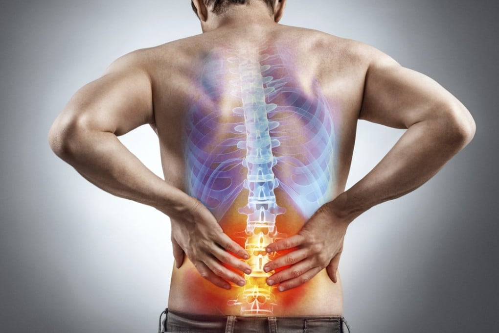 Lower back pain, such as from sciatica, can be debilitating. Photo: Shutterstock