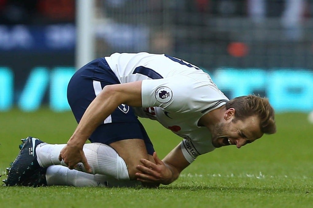 Injured Tottenham Hotspurs striker Harry Kane will miss England’s upcoming friendly matches. Photo: EPA