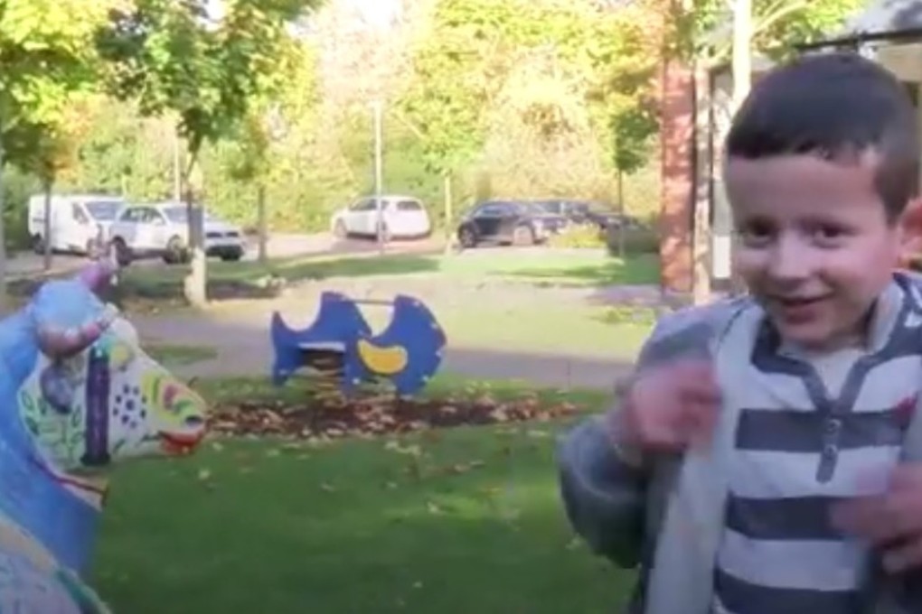 Hassam was admitted to hospital in June 2015 with the ‘devastating’ effects of a genetic disease called Junctional epidermolysis bullosa (JEB) that has tormented him since birth. Gene therapy has saved his life. Photo: Handout