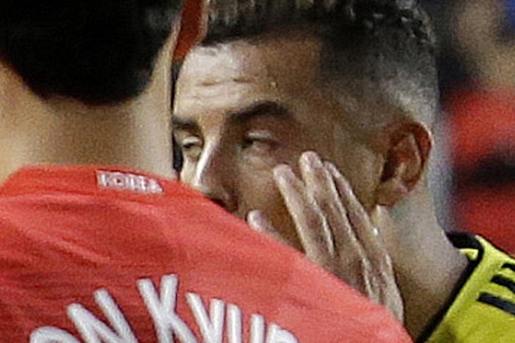 Colombia’s Edwin Cardona makes a derogatory gesture during the friendly against South Korea at Suwon World Cup Stadium south of Seoul. Photo: AP