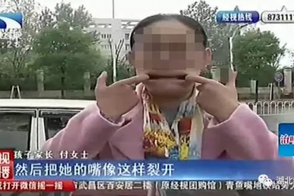 One of the children’s mothers told a TV station that a teacher forcibly pulled their mouth apart. Photo: Handout