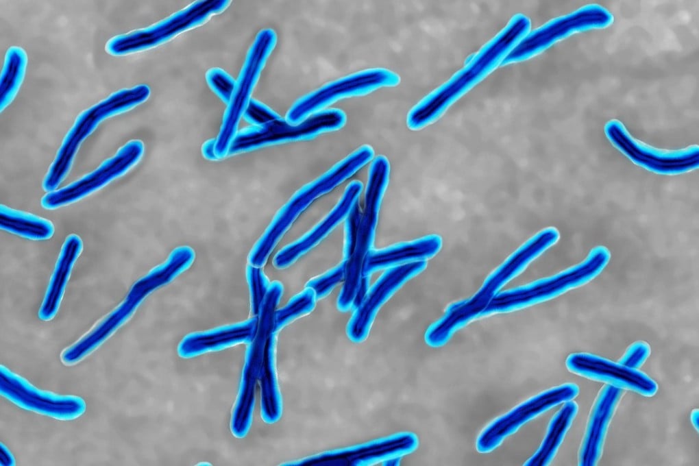 Hong Kong recorded 4,412 infection cases and 155 deaths last year. Photo: Alamy