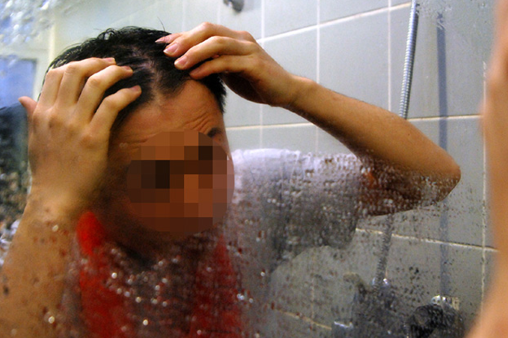 The team led by Choi Kang-yeol of Yonsei University discovered that a protein called CXXC5 acts as negative regulator of the Wnt signalling pathway inside of a cell that is linked to follicle development and hair regeneration in adults. Photo: Korea Times