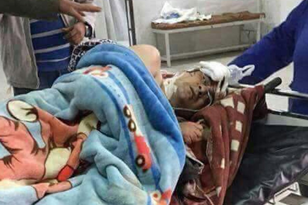 A victim of the mosque attack in hospital in Ismailia. Photo: EPA