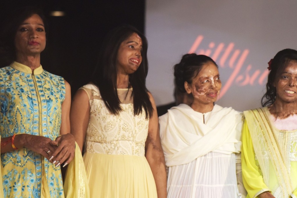 Indian acid attack survivors pose at the end of the fashion show organised by the ‘Make Love Not Scars’ NGO in New Delhi. Photo: AFP
