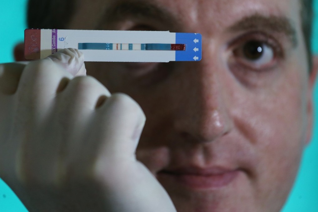 Andrew Chidgey said the cuts forced his group to suspend HIV rapid tests. Photo: Dickson Lee