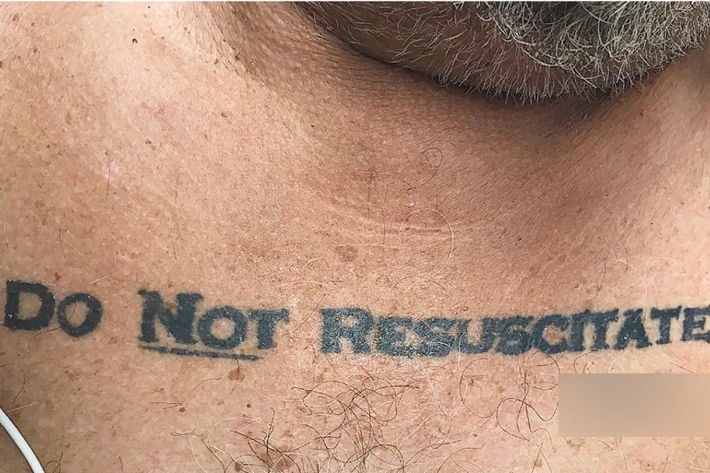 This tattoo was found on an unconscious 70-year-old patient in Florida, thrusting an ethical dilemma upon doctors. The blurred section carried the man’s signature. Photo: NEJM
