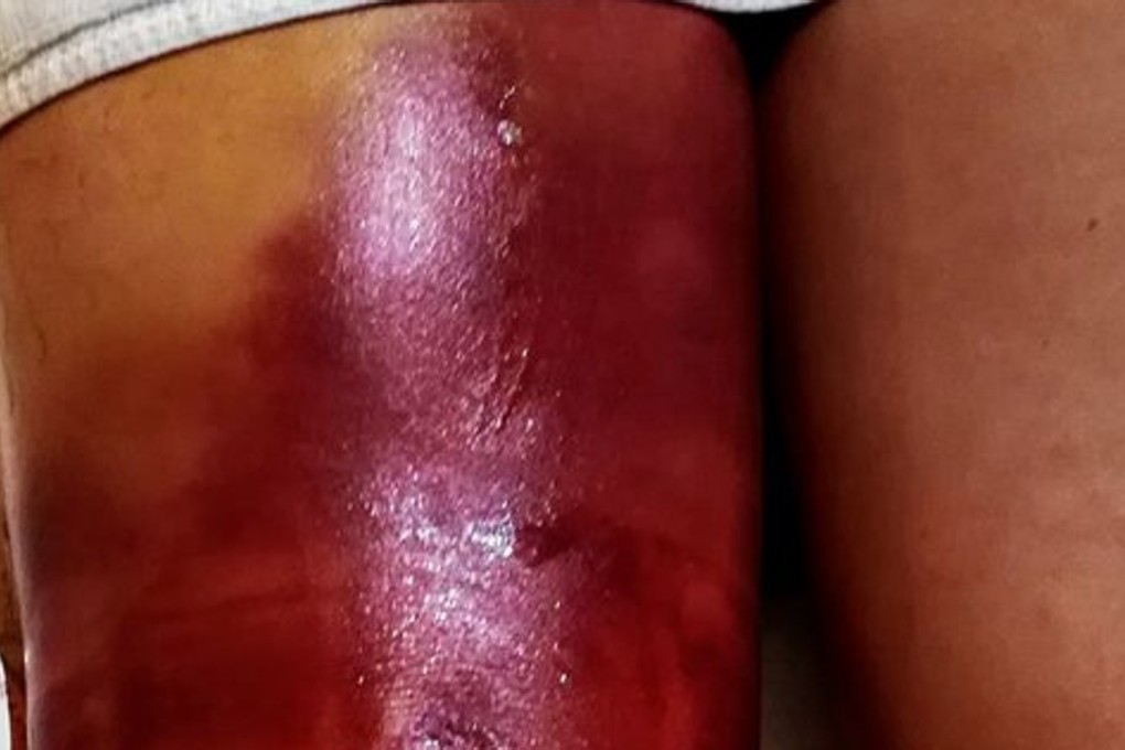 Brian Cook put his quick recovery down to diet, supplements, oils and gels and family support. Photo: Handout