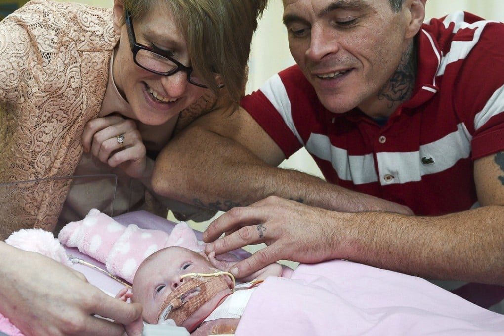 Naomi Findlay and Dean Wilkins look at their daughter, three-week-old Vanellope Hope Wilkins who was born with an extremely rare condition in which the heart grows outside the body. Photo: PA via AP