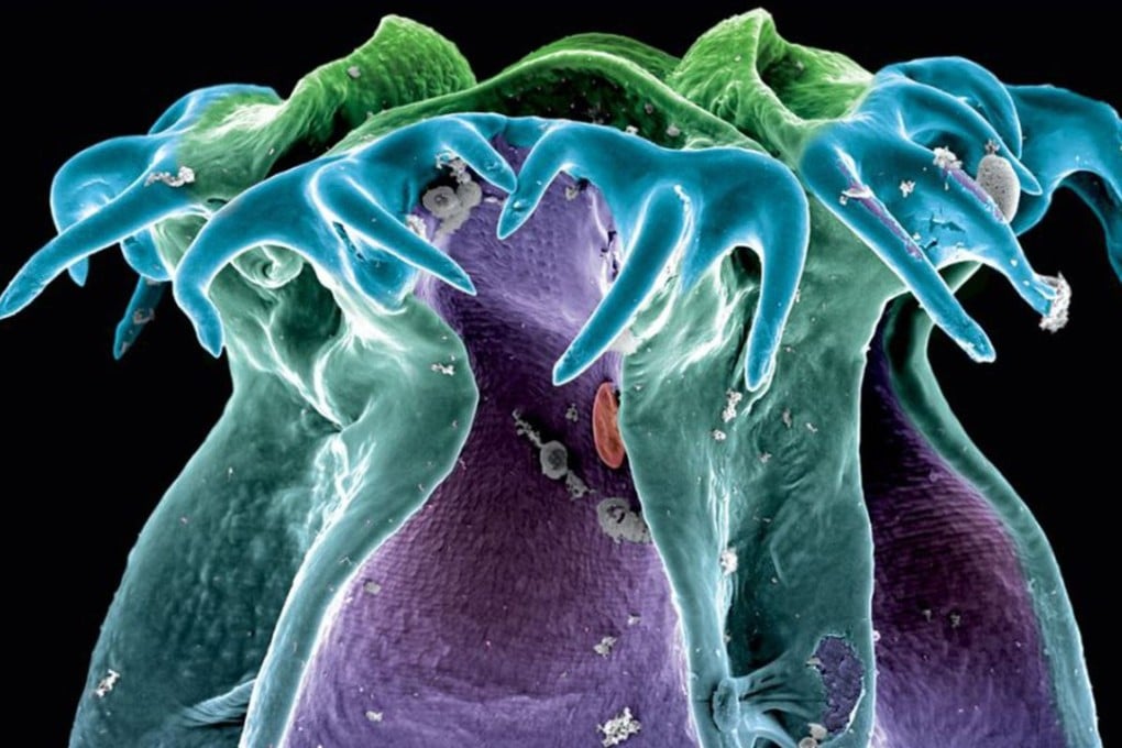 Phoreiobothrium jahki, a tapeworm that Janine Caira calls “eye candy.” A dentist bought the naming rights to this species for US$3,000. Photo: Handout