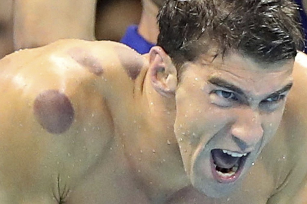 Michael Phelps has 28 Olympic medals, 23 of them gold. Photo: AP