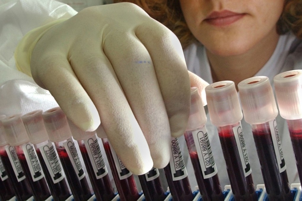 Scientists have developed a blood test that can detect signs of eight types of cancer before symptoms arise. (Don Bartletti/Los Angeles Times/TNS)
