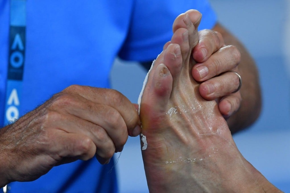 South Korea’s Chung Hyeon receives medical attention on his foot. Photo: AFP