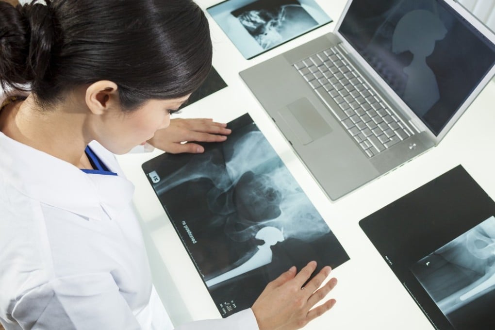 Bargain: hip replacements in Malaysia. Photo: Shutterstock