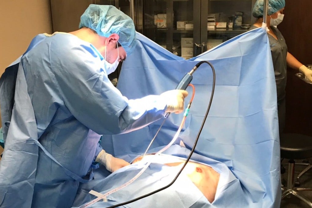 Marwan Khalifeh, a cosmetic surgeon in Washington, the US, performs a breast reduction procedure on a male patient. Photo: Eric Pianin