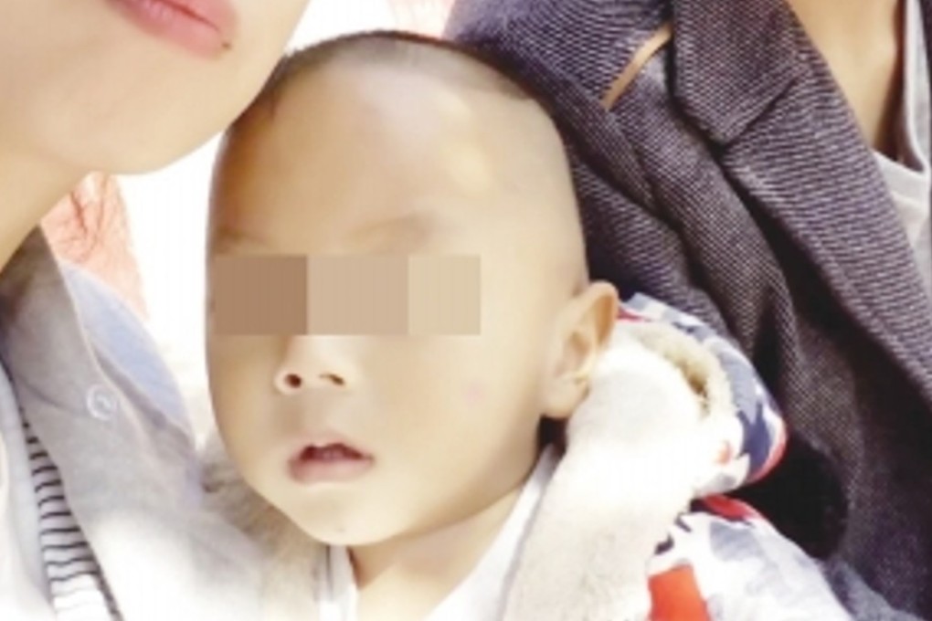 The baby boy who died from his injuries 20 months after a serious road accident. Photo: Aihami.com